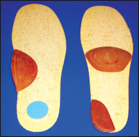 Left: Scaphoid pad and heel plug. Right: Met bar and heel wedge.
