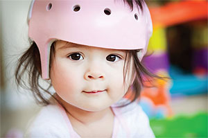 infant in cranial helmet