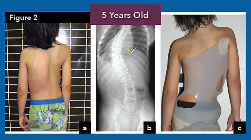 patient at 5 yrs