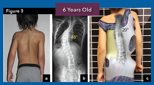 patient at 6 yrs