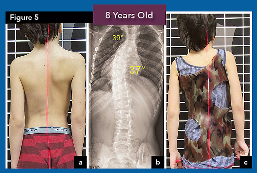 patient at 8 yrs