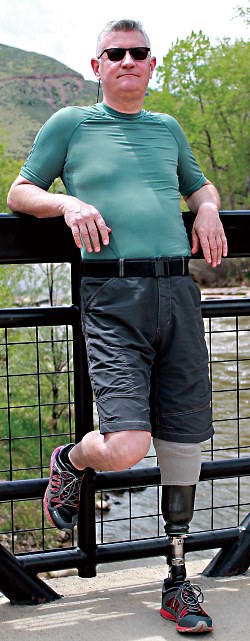 BK amputee leaning on fence