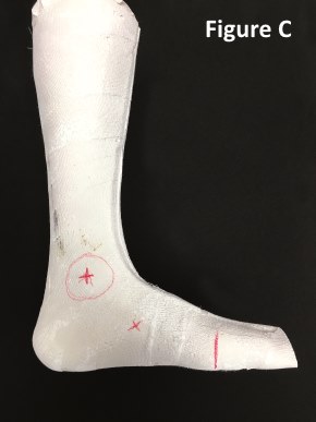 Figure C