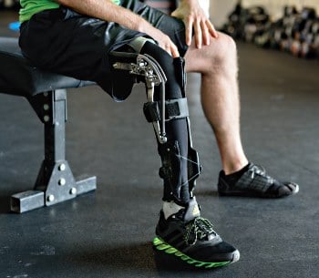Max Conserva's orthosis