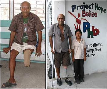 Luiz Ramirez waits patiently for his prosthesis (left), and is standing in front of the clinic with his grandson (right)