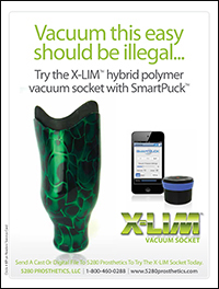 /Content/UserFiles/PrintAds/5280prosthetics/E-5280-X-LIM-13Nov.jpg /Content/UserFiles/PrintAds/5280prosthetics/E-5280-X-LIM-13Nov.jpg