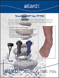 /Content/UserFiles/PrintAds/allard/E-Allard_ToeOff.jpg /Content/UserFiles/PrintAds/allard/E-Allard_ToeOff.jpg