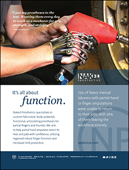 /Content/UserFiles/PrintAds/naked-pros/19Feb-Naked-Prosthetics-Ad.jpg /Content/UserFiles/PrintAds/naked-pros/19Feb-Naked-Prosthetics-Ad.jpg