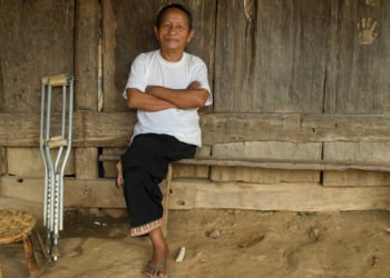 Hmong hill tribe man who is an amputee after having his leg blown off by a lnad mine on the Loas/Thailand border