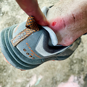 An Orthotist’s Perspective on Blister Prevention From Hiking the Camino de Santiago Trail