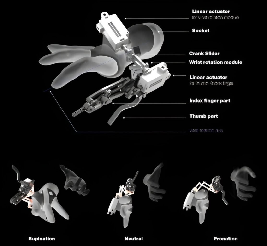 Prosthetic Rotation Unit Wrist-rotatable Prosthesis Makes for More Natural Movement - The O&P ...