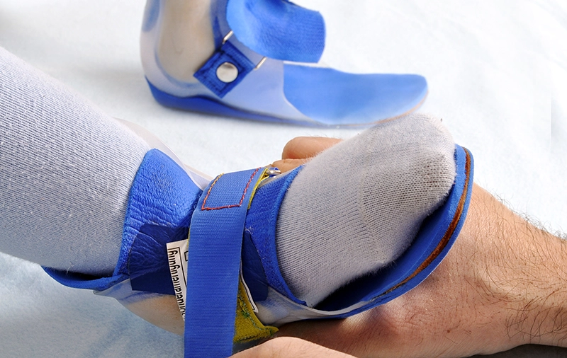 Carbon Fiber, Hinged AFOs Both Effective for Foot Drop in CP - The O&P ...