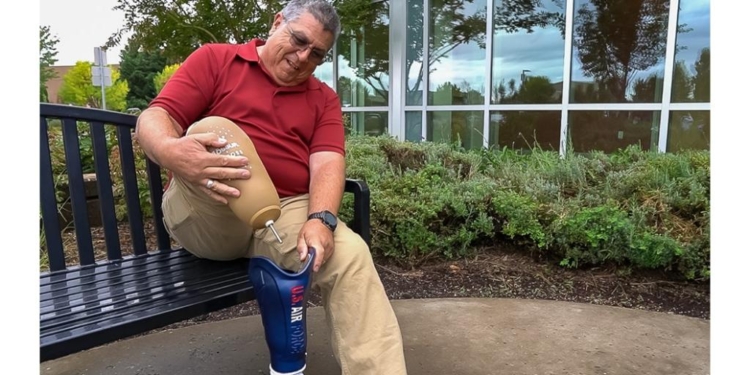 Stuart is the first veteran to receive a 3D-printed prosthetic socket fabricated using the VA’s integrated workflow. Photograph by VA Puget Sound photographer Oscar Valenzuela.