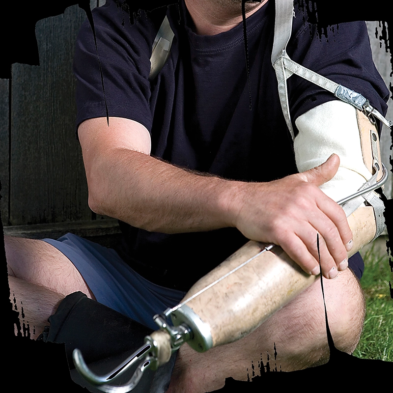 How to Develop a New Body-Powered Terminal Device: A Story of Opportunities and Challenges
