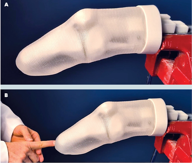 Developing an Innovative Amputated Limb Simulator to Advance Clinicians’ Skills