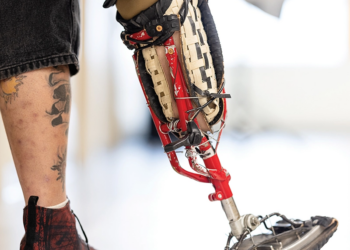 The concept behind Hogan’s Project Bike Leg came from a rudimentary design he saw online using a bike frame with plaster for a prosthetic socket.