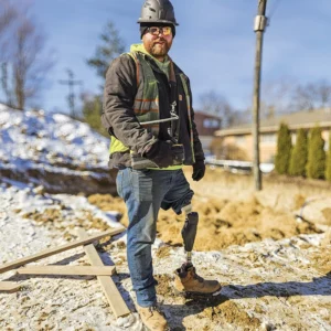 How Osseointegration Gave Tre Adkins His Life Back