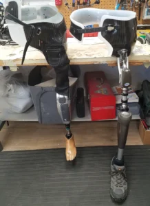 Design and Outcome Considerations for Hip Disarticulation Patients: Part III